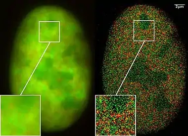 超高分辨率顯微鏡：共定位顯微鏡（2CLM），綠色螢光蛋白（GFP）和紅色螢光蛋白（RFP）融合蛋白（骨癌細胞的細胞核）