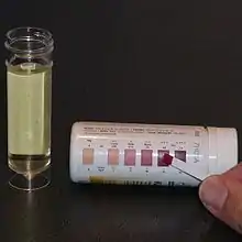 試紙與色表,比對試紙與色表上的顏色,顯示酮尿症的程度。