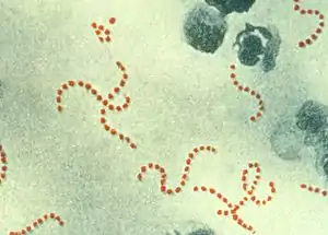 Chains of "S. pyogenes" bacteria